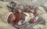 baby in the NICU being monitored by accelerometers